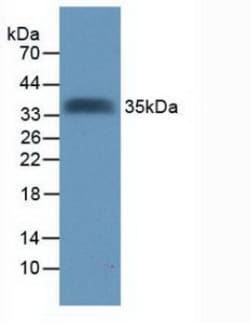 Invitrogen&trade;&nbsp;TMEFF2 Polyclonal Antibody