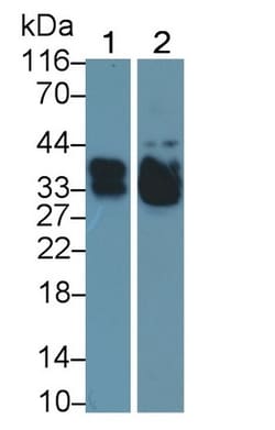 Invitrogen&trade;&nbsp;SFTPA2 Polyclonal Antibody