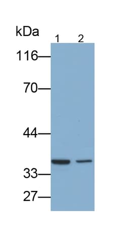Invitrogen&trade;&nbsp;SFTPA2 Polyclonal Antibody