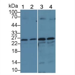 Invitrogen GSTM1 Polyclonal Antibody 200 &mu;L; Unconjugated:Antibodies,