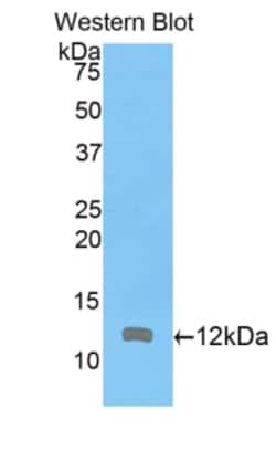 Invitrogen&trade;&nbsp;ARPC4 Polyclonal Antibody