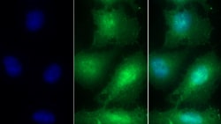 Invitrogen&trade;&nbsp;TMSB4X Polyclonal Antibody