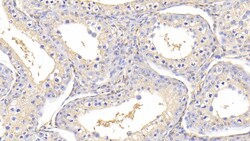 Invitrogen TMSB4X Polyclonal Antibody 200 &mu;L; Unconjugated:Antibodies,