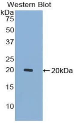 Invitrogen&trade;&nbsp;GDF7 Polyclonal Antibody