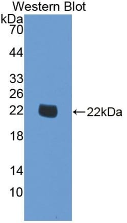 Invitrogen SMOX Polyclonal Antibody 200 &mu;L; Unconjugated:Antibodies,
