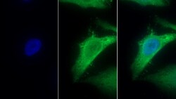 Invitrogen MTNR1A Polyclonal Antibody 200 &mu;L; Unconjugated:Antibodies,
