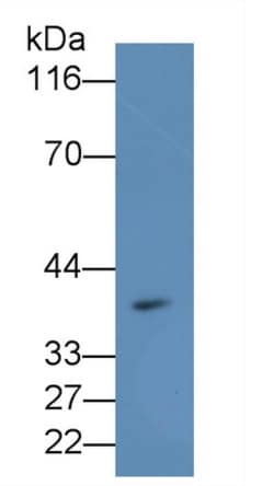 Invitrogen&trade;&nbsp;MTNR1A Polyclonal Antibody