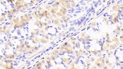 Invitrogen NUP205 Polyclonal Antibody 200 &mu;L; Unconjugated:Antibodies,