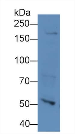 Invitrogen&trade;&nbsp;NUP205 Polyclonal Antibody