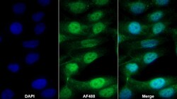 Invitrogen RelB Polyclonal Antibody 200 &mu;L; Unconjugated:Antibodies,