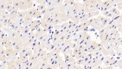 Invitrogen&trade;&nbsp;MRLC2 Polyclonal Antibody