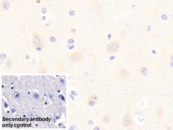 Invitrogen mGluR3 Polyclonal Antibody 200 &mu;L; Unconjugated:Antibodies,
