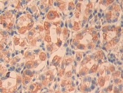 Invitrogen CYR61 Polyclonal Antibody 200 &mu;L; Unconjugated:Antibodies