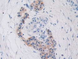 Invitrogen CYR61 Polyclonal Antibody 200 &mu;L; Unconjugated:Antibodies