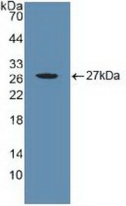 Invitrogen CYR61 Polyclonal Antibody 200 &mu;L; Unconjugated:Antibodies