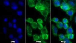 Invitrogen Complement C4b Polyclonal Antibody 200 &mu;L; Unconjugated:Antibodies,