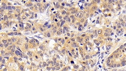Invitrogen CCL16 Polyclonal Antibody 200 &mu;L; Unconjugated:Antibodies,