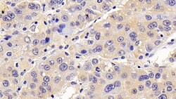 Invitrogen CCL16 Polyclonal Antibody 200 &mu;L; Unconjugated:Antibodies,