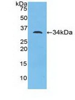 Invitrogen&trade;&nbsp;MYO1D Polyclonal Antibody