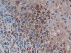 Invitrogen&trade;&nbsp;CCL3L1 Polyclonal Antibody