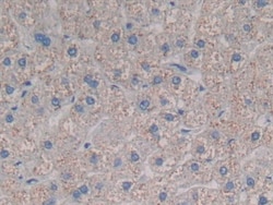 Invitrogen CCL3L1 Polyclonal Antibody 200 &mu;L; Unconjugated:Antibodies,