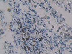 Invitrogen&trade;&nbsp;MCP-4 Polyclonal Antibody