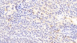 Invitrogen IL1RA Polyclonal Antibody 200 &mu;L; Unconjugated:Antibodies,