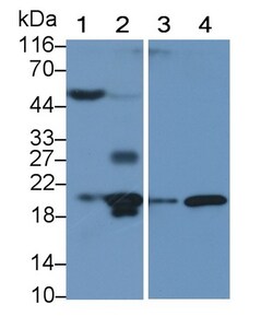 Invitrogen IL1RA Polyclonal Antibody 200 &mu;L; Unconjugated:Antibodies,
