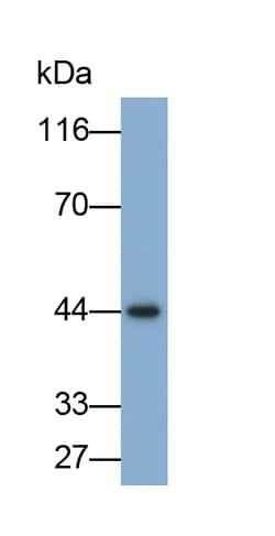 Invitrogen&trade;&nbsp;SERPINB3 Polyclonal Antibody