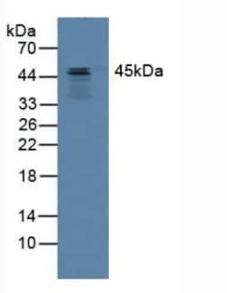 Invitrogen&trade;&nbsp;SERPINB3 Polyclonal Antibody