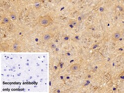 Invitrogen&trade;&nbsp;PKC alpha Polyclonal Antibody
