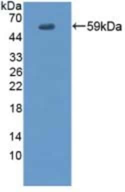 Invitrogen&trade;&nbsp;EVPL Polyclonal Antibody