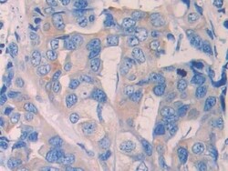 Invitrogen Renalase Polyclonal Antibody 200 &mu;L; Unconjugated:Antibodies,