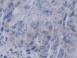 Invitrogen&trade;&nbsp;Neuropilin 2 Polyclonal Antibody