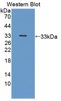 Invitrogen&trade;&nbsp;Neuropilin 2 Polyclonal Antibody