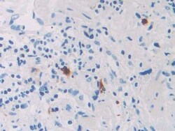 Invitrogen RNASE8 Polyclonal Antibody 200 &mu;L; Unconjugated:Antibodies,