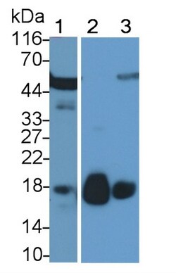 Invitrogen RNASE8 Polyclonal Antibody 200 &mu;L; Unconjugated:Antibodies,
