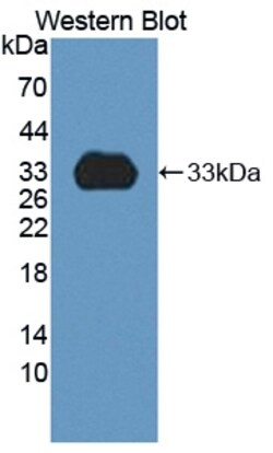 Invitrogen&trade;&nbsp;CYP1A2 Polyclonal Antibody