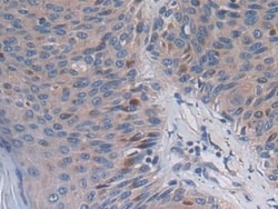 Invitrogen&trade;&nbsp;PCSK5 Polyclonal Antibody
