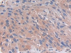 Invitrogen&trade;&nbsp;PCSK5 Polyclonal Antibody