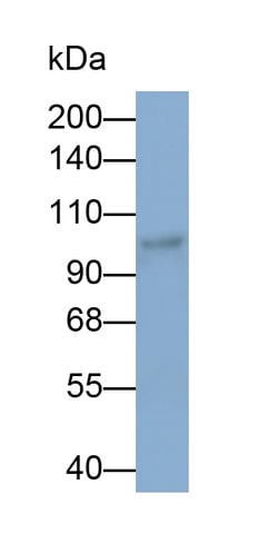 Invitrogen&trade;&nbsp;PCSK5 Polyclonal Antibody