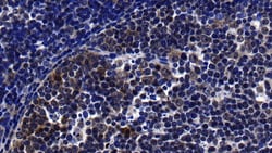 Invitrogen&trade;&nbsp;LECT2 Polyclonal Antibody
