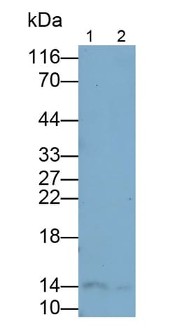 Invitrogen&trade;&nbsp;FABP1 Polyclonal Antibody