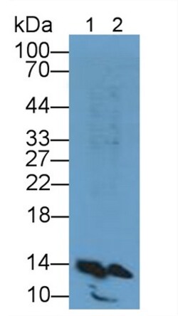 Invitrogen FABP1 Polyclonal Antibody 200 &mu;L; Unconjugated:Antibodies,