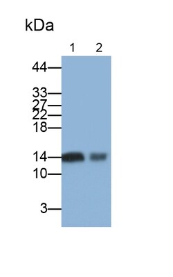 Invitrogen FABP1 Polyclonal Antibody 200 &mu;L; Unconjugated:Antibodies,
