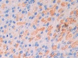 Invitrogen CA7 Polyclonal Antibody 200 &mu;L; Unconjugated:Antibodies,