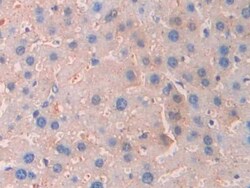 Invitrogen CA7 Polyclonal Antibody 200 &mu;L; Unconjugated:Antibodies,