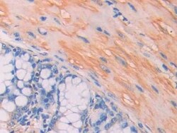Invitrogen CA7 Polyclonal Antibody 200 &mu;L; Unconjugated:Antibodies,