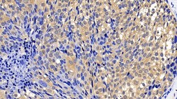 Invitrogen Bcl-W Polyclonal Antibody 200 &mu;L | Buy Online | Invitrogen&trade; | Fisher Scientific