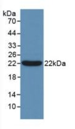 Invitrogen Bcl-W Polyclonal Antibody 200 &mu;L | Buy Online | Invitrogen&trade; | Fisher Scientific